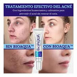 Crema Anti acné Elimina Espinillas